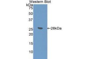 Western Blotting (WB) image for anti-BH3 Interacting Domain Death Agonist (BID) (AA 1-195) antibody (ABIN3208215) (BID 抗体  (AA 1-195))