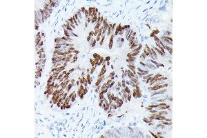 Immunohistochemistry of paraffin-embedded rat lung using GAPDH Mouse mAb (ABIN3020540, ABIN3020541, ABIN3020542 and ABIN1512934) at dilution of 1:100 (40x lens). (GAPDH 抗体)