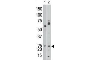 Western Blotting (WB) image for anti-BCL2/adenovirus E1B 19kDa Interacting Protein 3 (BNIP3) (BH3 Domain) antibody (ABIN2997216) (BNIP3 抗体  (BH3 Domain))