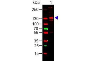 Western Blotting (WB) image for Collagen, Type III, alpha 1 (COL3A1) protein (ABIN5624594)
