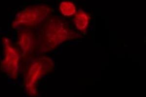 ABIN6267460 staining A549 by IF/ICC. (NOS1 抗体  (pSer852))