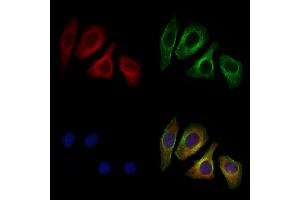 ABIN6262041 and ABIN6276973 staining Hela cells by IF/ICC. (Glypican 3 抗体  (N-Term))