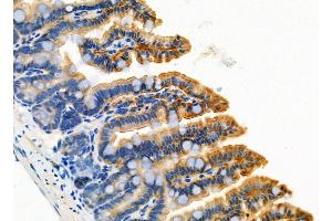 ABIN6261648 and ABIN6276771 at 1/100 staining Mouse colorectal tissue by IHC-P. (FABP2 抗体  (C-Term))