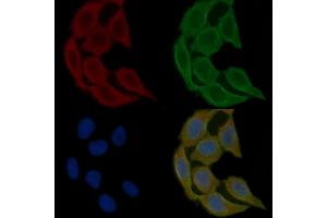 ABIN6265688 and ABIN6278646 staining Hela cells(30 min of UV treatment) by IF/ICC. (Tryptophan Hydroxylase 2 抗体  (N-Term))