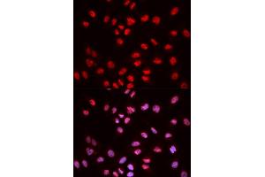 Immunofluorescence (IF) image for anti-ELK1, Member of ETS Oncogene Family (ELK1) (pSer383) antibody (ABIN1870156) (ELK1 抗体  (pSer383))
