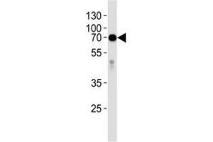 Western blot analysis of lysate from human placenta tissue lysate using anti-Alkaline Phosphatase antibody diluted at 1:1000. (Alkaline Phosphatase 抗体  (AA 274-304))