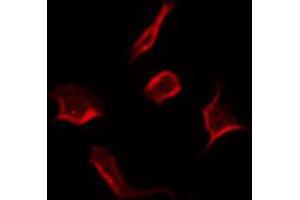 ABIN6266934 staining COLO205 by IF/ICC. (RNF144A 抗体  (Internal Region))