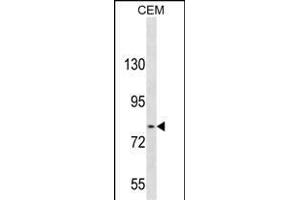 TGFBR Antibody (C-term) 3395b western blot analysis in CEM cell line lysates (35 μg/lane). (TGFBRAP1 抗体  (C-Term))