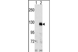 Western blot analysis of EphA3(arrow) using rabbit polyclonal EphA3 Antibody (C-term) (ABIN391888 and ABIN2841708).