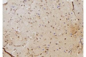 ABIN6264495 and ABIN6276345 at 1/100 staining Mouse brain tissue by IHC-P. (PSME3 抗体  (N-Term))