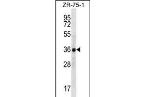 CCNYL2 Antibody (Center) (ABIN656247 and ABIN2845564) western blot analysis in ZR-75-1 cell line lysates (35 μg/lane). (CCNYL2 抗体  (AA 162-191))