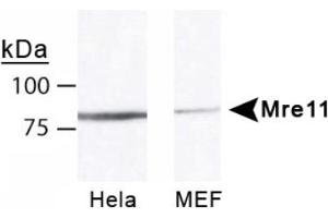 Image no. 1 for anti-MRE11 Meiotic Recombination 11 Homolog A (S. Cerevisiae) (MRE11A) antibody (ABIN363310) (Mre11 抗体)