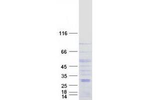 Western Blotting (WB) image for Bestrophin 3 (BEST3) (Transcript Variant 2) protein (Myc-DYKDDDDK Tag) (ABIN2715225)