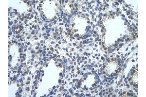 Rabbit Anti-BLZF1 Antibody       Paraffin Embedded Tissue:  Human alveolar cell   Cellular Data:  Epithelial cells of renal tubule  Antibody Concentration:   4. (BLZF1 抗体  (C-Term))