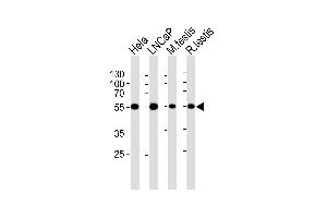 Western blot analysis of lysates from Hela, LNCaP cell line, mouse testis and rat testis tissue lysates(from left to right), using ULK3 Antibody (C-term) (ABIN6243328 and ABIN6577077). (ULK3 抗体  (C-Term))