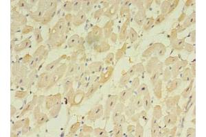 Immunohistochemistry of paraffin-embedded human heart tissue using ABIN7173155 at dilution of 1:100 (TMEM222 抗体  (AA 77-164))