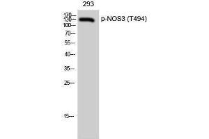 Western Blotting (WB) image for anti-Nitric Oxide Synthase 3 (Endothelial Cell) (NOS3) (pThr494) antibody (ABIN3182095) (ENOS 抗体  (pThr494))