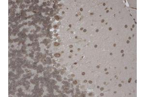 Immunohistochemistry (IHC) image for anti-Transient Receptor Potential Cation Channel, Subfamily M, Member 7 (TRPM7) (AA 1817-1863) antibody (Biotin) (ABIN2483114)