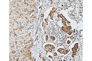 IHC analysis of DDR1 using anti-DDR1 antibody (ABIN7601407). (DDR1 抗体  (AA 341-909))