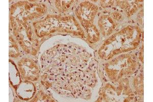 IHC image of ABIN7140036 diluted at 1:200 and staining in paraffin-embedded human kidney tissue performed on a Leica BondTM system. (Paxillin 抗体  (AA 28-45))