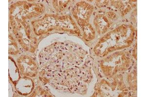IHC image of ABIN7140036 diluted at 1:200 and staining in paraffin-embedded human kidney tissue performed on a Leica BondTM system.