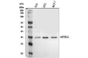 Western blot analysis of Meteorin-like/METRNL using anti-Meteorin-like/METRNL antibody (ABIN7602241).
