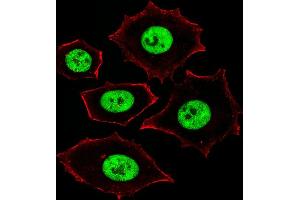 Fluorescent image of MCF-7 cells stained with ZN Antibody (Center) (ABIN1882027 and ABIN2843373). (Zinc Finger and SCAN Domain Containing 32 (ZSCAN32) (AA 159-187) 抗体)