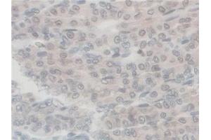 Immunohistochemistry (IHC) image for anti-G-Elongation Factor, Mitochondrial 1 (GFM1) (AA 511-751) antibody (ABIN7444172)