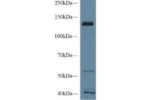 Western Blotting (WB) image for anti-Meningioma Expressed Antigen 5 (Hyaluronidase) (MGEA5) (AA 6-240) antibody (ABIN7430753)