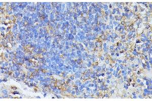 Immunohistochemistry of paraffin-embedded Mouse spleen using STK24 Polyclonal Antibody at dilution of 1:100 (40x lens). (STK24 抗体)