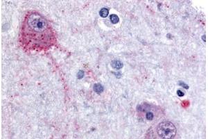 Immunohistochemistry (IHC) image for anti-Proprotein Convertase Subtilisin/kexin Type 6 (PCSK6) (Internal Region) antibody (ABIN1049226)