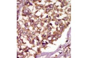 Image no. 2 for anti-BMX Non-Receptor Tyrosine Kinase (BMX) (Middle Region) antibody (ABIN359973)