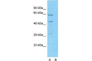 Western Blotting (WB) image for anti-Solute Carrier Family 27 (Fatty Acid Transporter), Member 2 (SLC27A2) (N-Term) antibody (ABIN2781594)