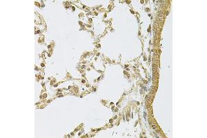 Immunohistochemistry of paraffin-embedded rat lung using PSMA5 Antibody (ABIN6292510) at dilution of 1:100 (40x lens). (PSMA5 抗体)