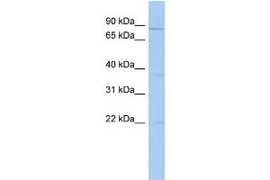 WB Suggested Anti-PCSK4 Antibody Titration: 0. (PCSK4 抗体  (N-Term))