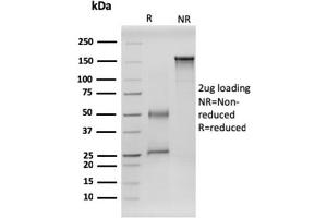 SDS-PAGE Analysis Purified RET-Monospecific Mouse Monoclonal Antibody (RET/2599). (Ret Proto-Oncogene 抗体  (AA 702-848))