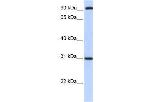 Human HeLa; WB Suggested Anti-ANKRA2 Antibody Titration: 0. (ANKRA2 抗体  (C-Term))