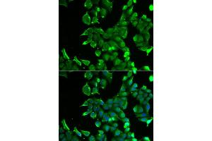 Immunofluorescence analysis of HeLa cell using STOM antibody. (Stomatin 抗体)