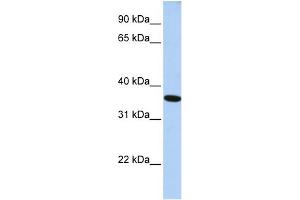 WB Suggested Anti-GTF2A1 Antibody Titration: 0. (GTF2A1 抗体  (N-Term))