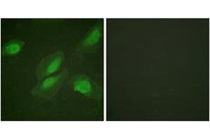 Immunofluorescence analysis of HeLa cells, using Akt (Ab-326) Antibody. (AKT1 抗体  (AA 292-341))