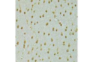 Immunohistochemistry of paraffin-embedded rat brain using RCC1 antibody (ABIN5973761) at dilution of 1/100 (40x lens). (RCC1 抗体)