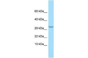 WB Suggested Anti-C1QTNF3 Antibody Titration: 1. (C1QTNF3 抗体  (N-Term))