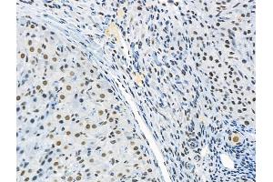 ABIN6256213 and ABIN6267090 at 1/100 staining Rat ovarian tissue by IHC-P. (RUNX1 抗体  (pSer249))