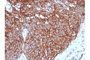 Immunohistochemistry (IHC) image for anti-Solute Carrier Family 2 (Facilitated Glucose Transporter), Member 1 (SLC2A1) (AA 203-305) antibody (ABIN6940597)
