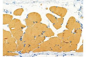 ABIN6266228 and ABIN6277417 at 1/100 staining Rat skin tissue by IHC-P. (HCRTR2 抗体  (N-Term))