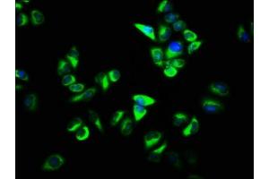 Immunofluorescence staining of Hela cells with ABIN7162395 at 1:133, counter-stained with DAPI. (OSBP 抗体  (AA 628-802))