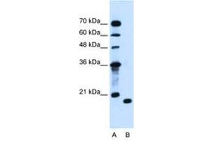 Image no. 1 for anti-Peptidyl-tRNA Hydrolase 2 (PTRH2) (AA 100-149) antibody (ABIN205058) (PTRH2 抗体  (AA 100-149))