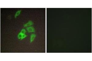 Immunofluorescence analysis of A549 cells, using ST14 Antibody. (ST14 抗体  (AA 10-59))