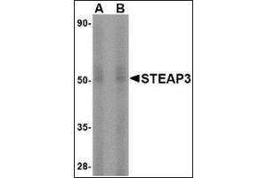 Western blot analysis of STEAP3 in rat liver tissue lysate with this product at (A) 1 and (B) 2 μg/ml. (STEAP3 抗体  (N-Term))