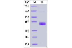 Biotinylated Human Angiopoietin-2, His,Avitag on  under reducing (R) condition. (Angiopoietin 2 Protein (ANGPT2) (AA 275-496) (His tag,AVI tag,Biotin))